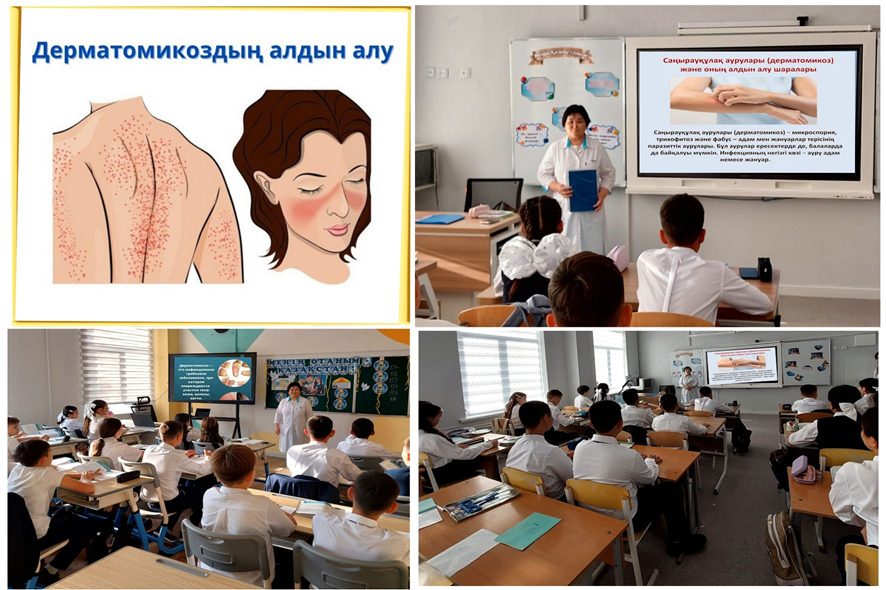 “Педикулездің алдын алу шаралары”